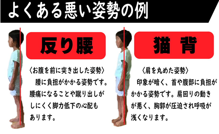 反り腰や猫背は、大人だけでなく子供にも起こる悪い姿勢の特徴で、腰痛にもつながるので姿勢づくりが必要